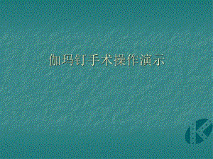 伽玛钉手术操作演示.ppt