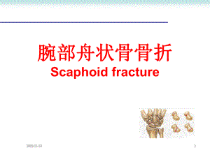 腕部舟状骨骨折.ppt