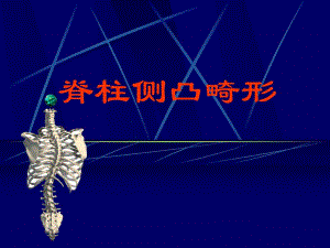 脊柱侧弯.ppt