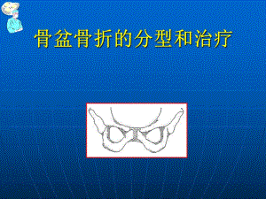 骨盆骨折的分型和治疗.ppt