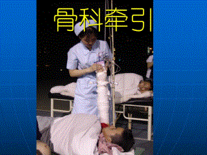骨科牵引PPT.ppt