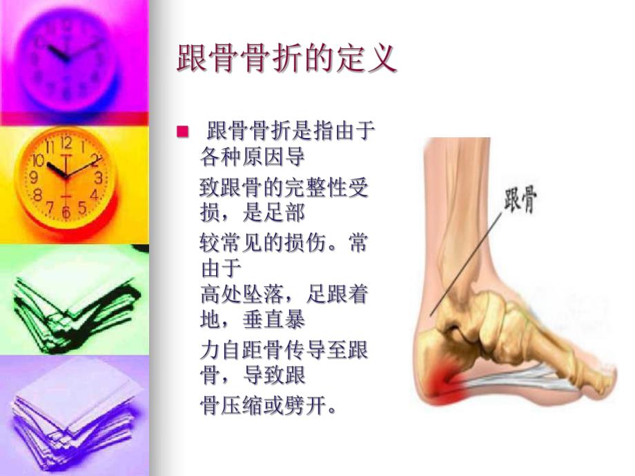 跟骨骨折病人的护理.ppt_第2页
