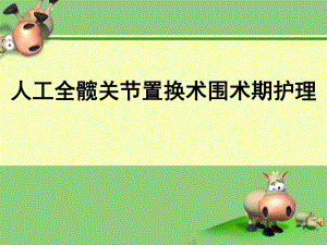 人工全髋关节置换术围术期护理.ppt