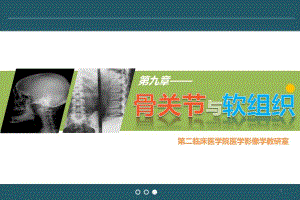 骨检查技术与软组织正常表现.ppt