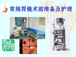 常规胃镜术前准备及护理.ppt