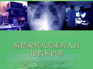危重病人的观察和护理.ppt