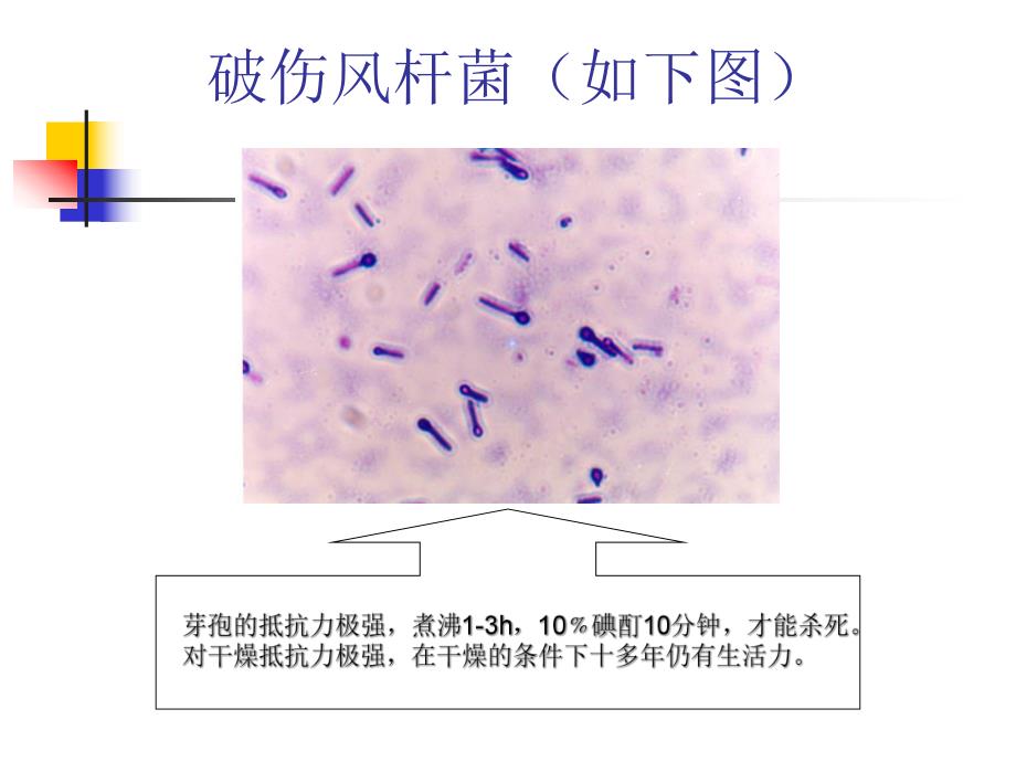 破伤风患者的护理.ppt_第3页
