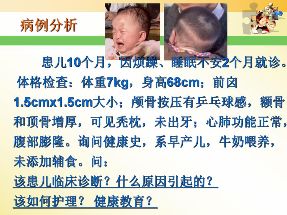 佝偻病患儿护理.ppt_第2页