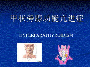 甲状旁腺功能亢进.ppt