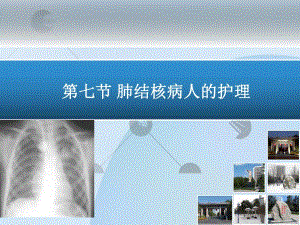 [临床医学]7第七节 肺结核病人的护理.ppt