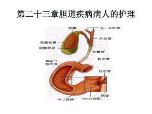 胆道疾病病人的护理.ppt