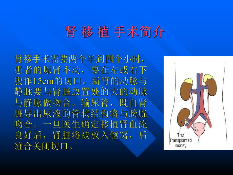肾移植术后的护理.ppt_第2页