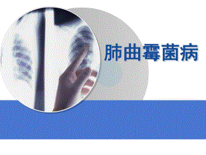 肺曲霉菌病护理新精要.ppt