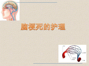 脑梗死的护理.ppt