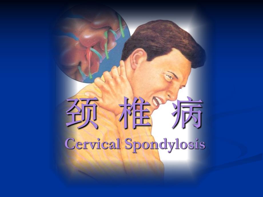 颈椎病护理查房.ppt_第1页