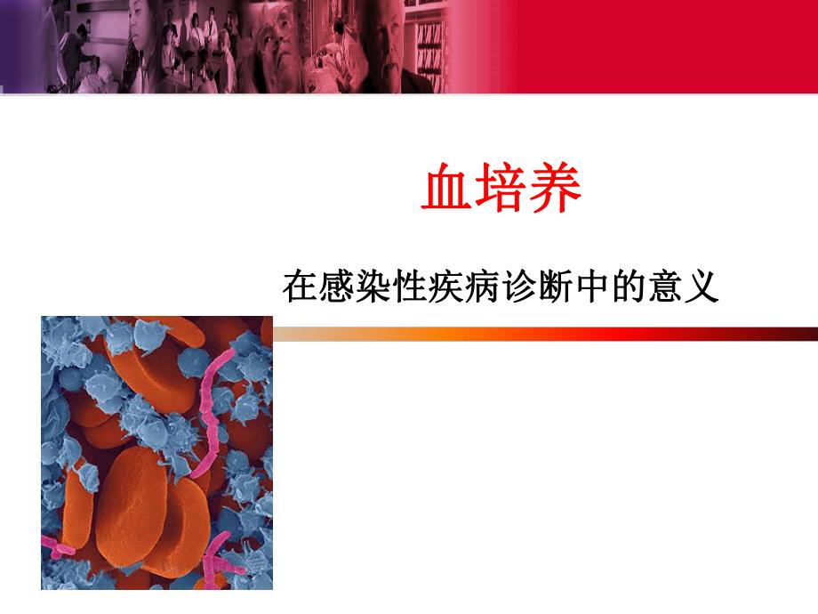 血培养在感染性疾病诊断中的意义.ppt_第1页