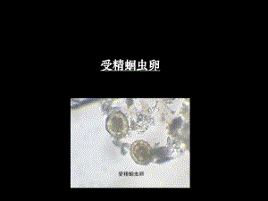 人体寄生虫标本考试.ppt