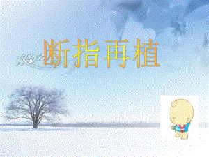 断指再植.ppt