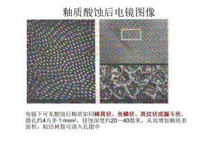 口腔粘结修复技术2.ppt
