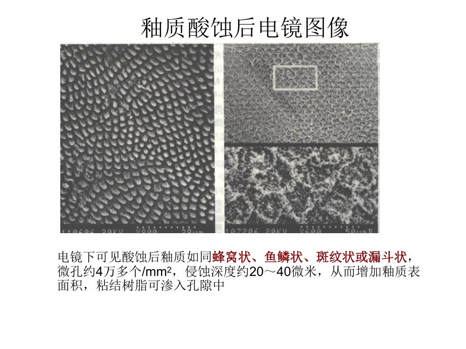 口腔粘结修复技术2.ppt_第1页