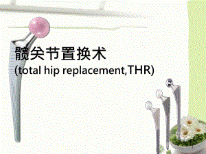髋关节置换术后康复护理.ppt