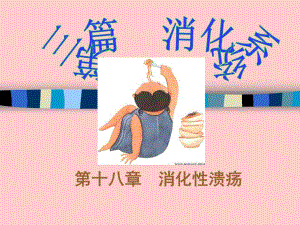 消化性溃疡课件.ppt