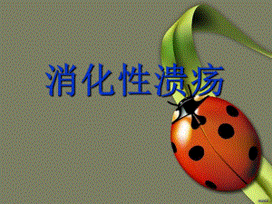 消化性溃疡1.ppt