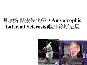 肌萎缩侧索硬化临床诊断进展.ppt