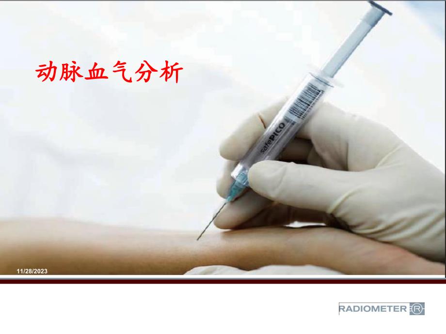 动脉血气分析.ppt_第1页