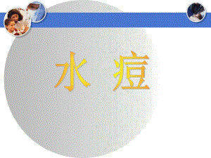 水痘.ppt.ppt