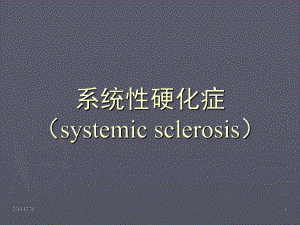 【医学课件】系统性硬化症.ppt