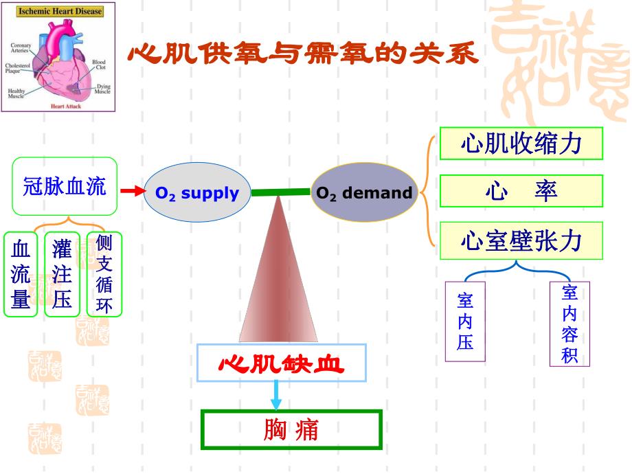 医学资料心绞痛小讲课.ppt_第3页