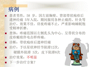 神经阻滞技术在临床疼痛中的应用.ppt