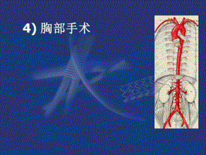 阜外大血管：胸主动脉手术.ppt
