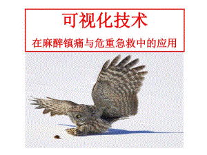 [医药卫生]可视化技术在麻醉中的应用.ppt