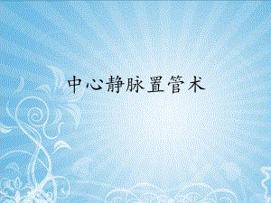 深静脉置管.ppt