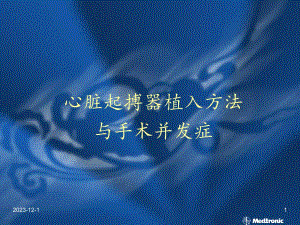 心脏起搏器植入方法.ppt