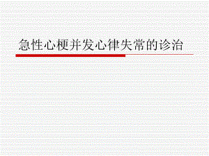 急性心梗并发心律失常的诊治.ppt