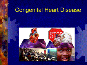 心血管系统疾病先天性心脏病（英文） .ppt