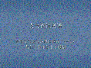 支气管镜图谱.ppt