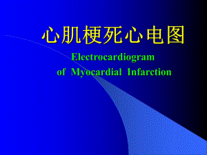 心肌梗死心电图.ppt