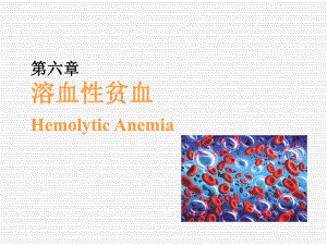溶血性贫血.ppt