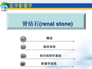 泌尿系统肾结石.ppt