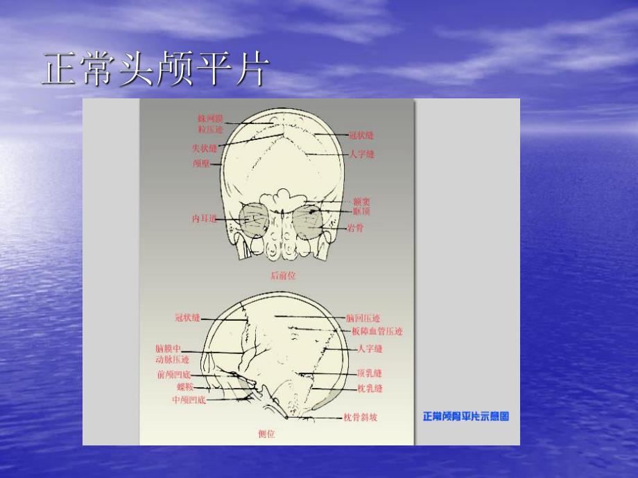 神经外科见习教学图片.ppt_第2页
