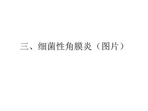 三、细菌性角膜炎(图片).ppt