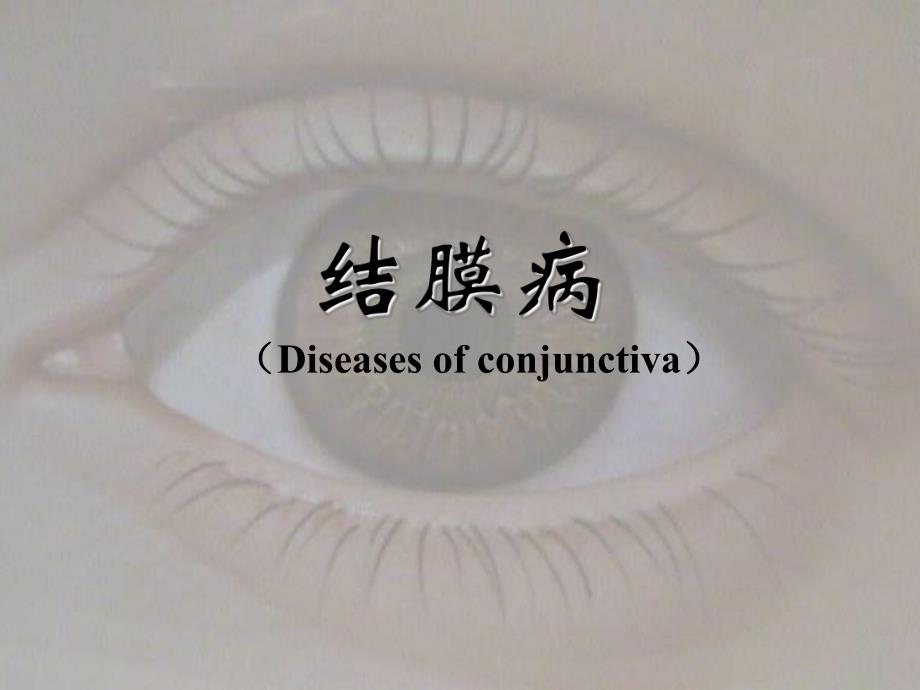 结膜病.ppt.ppt_第1页