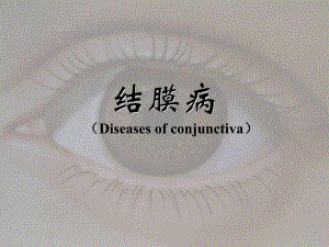 结膜病.ppt.ppt