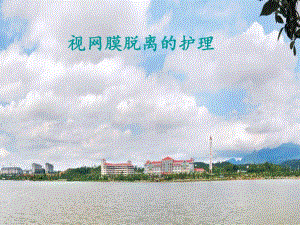 视网膜脱离的护理.ppt