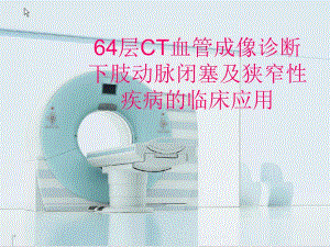 64层CT血管成像诊断下肢动脉闭塞及狭窄性疾病的临床应用.ppt