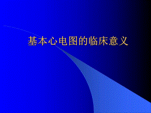 心电图岗前培训PPT幻灯片.ppt